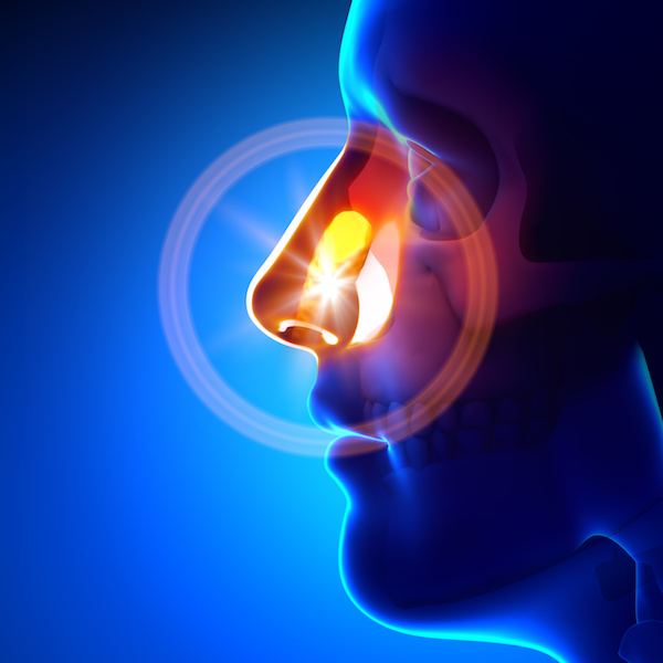 sinus augmentation